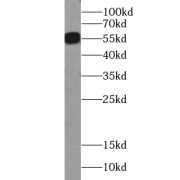 WB analysis of HEK-293 cells, using ZBTB8A antibody (1/1000 dilution).