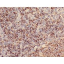 Zinc Finger CCCH Domain-Containing Protein 12D (ZC3H12D) Antibody