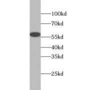 WB analysis of Raji cells, using ZC3H12D antibody (1/600 dilution).