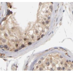 Zinc Finger CCCH-Type Antiviral Protein 1 (ZC3HAV1) Antibody