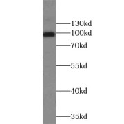 WB analysis of HEK-293 cells, using ZC3HAV1 antibody (1/4000 dilution).