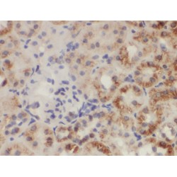 Zinc Finger CCCH-Type Antiviral Protein 1-Like (ZC3HAV1L) Antibody