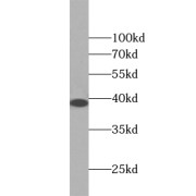 WB analysis of Jurkat cells, using ZC3HAV1L antibody (1/1000 dilution).