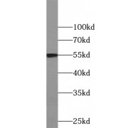 WB analysis of mouse lung tissue, using ZC3HC1 antibody (1/500 dilution).