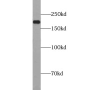 WB analysis of MCF7 cells, using ZCCHC11 antibody (1/500 dilution).