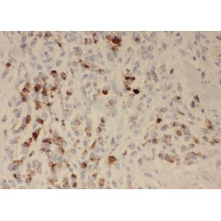 Palmitoyltransferase ZDHHC13 (ZDHHC13) Antibody