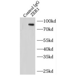 Protein Zer-1 Homolog (ZER1) Antibody