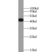 WB analysis of mouse lung tissue, using ZFP36 antibody (1/300 dilution).
