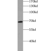 WB analysis of mouse testis tissue, using ZFP90 antibody (1/600 dilution).