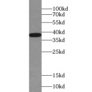 WB analysis of human brain tissue, using ZIC4-Specific antibody (1/500 dilution).