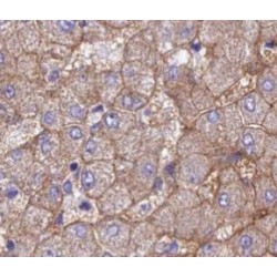 Zinc Transporter ZIP4 (ZIP4) Antibody