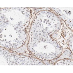 Zinc Finger Protein 174 (ZNF174) Antibody