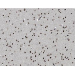 Zinc Finger Protein 18 (ZNF18) Antibody