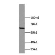 WB analysis of Jurkat cells, using ZNF18 antibody (1/300 dilution).