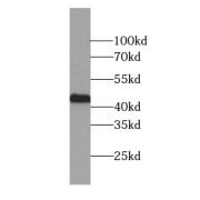 WB analysis of HeLa cells, using ZNF24 antibody (1/800 dilution).