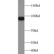 WB analysis of A549 cells, using ZNF287 antibody (1/300 dilution).