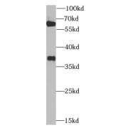 WB analysis of MCF7 cells, using ZNF346 antibody (1/1000 dilution).