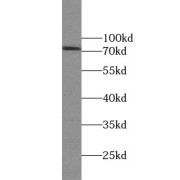 WB analysis of mouse ovary tissue, using ZNF443 antibody (1/500 dilution).