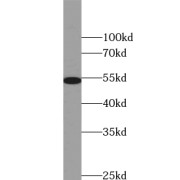 WB analysis of COLO 320 cells, using ZNF486 antibody (1/500 dilution).