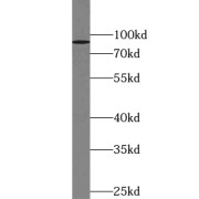 WB analysis of mouse skeletal muscle tissue, using ZNF509 antibody (1/600 dilution).