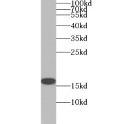 WB analysis of mouse spleen tissue, using ZNF593 antibody (1/200 dilution).