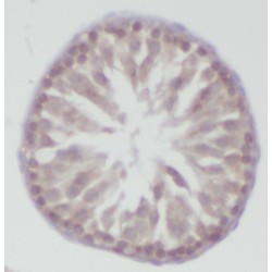 Zinc Finger Protein 746 (ZNF746) Antibody