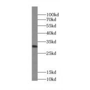 WB analysis of mouse kidney tissue, using ZNRF2-Specific antibody (1/300 dilution).