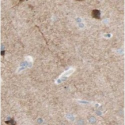 Zinc Transporter 3 (ZnT3) Antibody