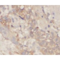 Zinc Transporter 7 (ZnT7) Antibody