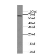 WB analysis of mouse lung tissue, using SLC30A7 antibody (1/500 dilution).