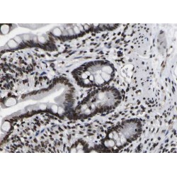 Zinc Finger And SCAN Domain-Containing Protein 20 (ZSCAN20) Antibody