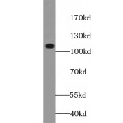 WB analysis of HepG2 cells, using ZSCAN20 antibody (1/1500 dilution).