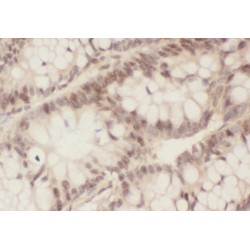 Protein Zwilch Homolog (ZWILCH) Antibody