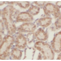 beta-ENaC Antibody