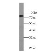 WB analysis of PC-3 cells, using β-ENaC antibody (1/500 dilution).