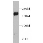 WB analysis of rat liver tissue, using IRS2 antibody (1/1000 dilution).