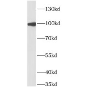 WB analysis of Recombinant proteins, using IL17RA antibody (1/1500 dilution).