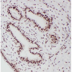 Progesterone Receptor (PR) Antibody