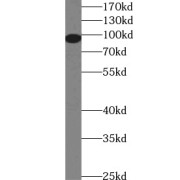 WB analysis of mouse uterus tissue, using PR antibody (1/1000 dilution).