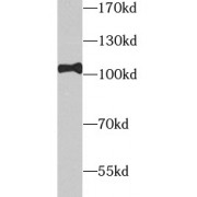 WB analysis of L02 cells, using TOP1 antibody (1/1000 dilution).