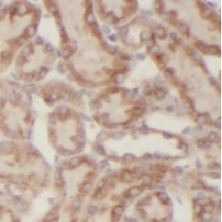 Ubiquitin Specific Peptidase 33 (USP33) Antibody