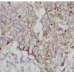 Epithelial Cell Adhesion Molecule (EPCAM) Antibody