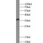 WB analysis of A431 cells, using EPCAM antibody (1/2000 dilution).