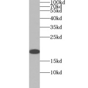 WB analysis of HeLa cells, using SURVIVIN antibody (1/2000 dilution).