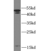 WB analysis of Jurkat cells, using Caspase 2 antibody (1/3000 dilution).