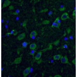 Huntingtin (HTT) Antibody