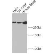 WB analysis of various cells, using Huntingtin antibody (1/1000 dilution).