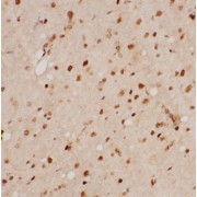 IHC-P analysis of Rat brain tissue, using melatonin antibody (1/200 dilution).