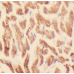 ATP Synthase Subunit Beta, Mitochondrial (ATP5F1B) Antibody