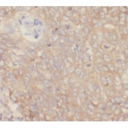 Vascular Cell Adhesion Molecule 1 (VCAM1) Antibody